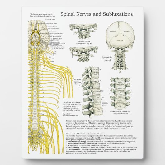 Plaque Photo Chiropratique Nerves spinales Subluxations Easel (Devant)