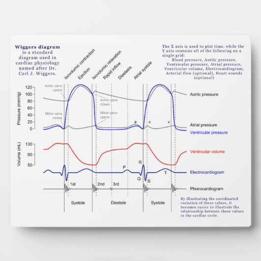 Plaque Photo Diagramme de Wiggers (Devant)