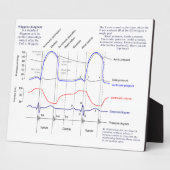 Plaque Photo Diagramme de Wiggers (Côté)