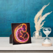 Plaque Photo Embryo (Insitu)