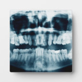 Plaque Photo Rayon X des dents (Devant)