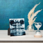 Plaque Photo Rayon X des dents (Insitu)