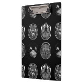 Porte-bloc Analyse IRM du cerveau (Gauche)