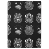 Porte-bloc Analyse IRM du cerveau (Dos)