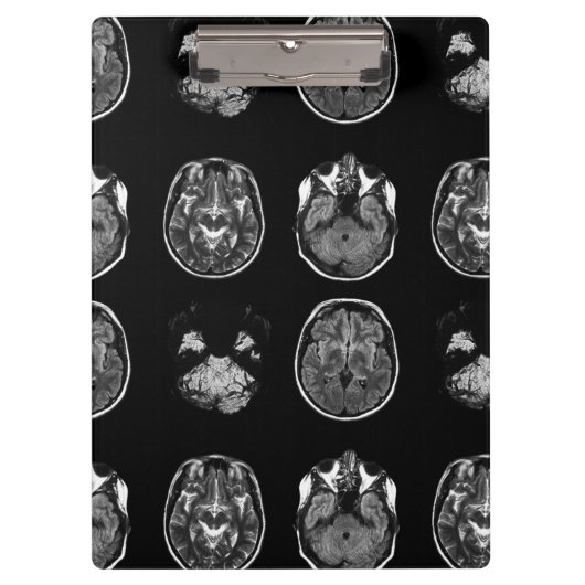 Porte-bloc Analyse IRM du cerveau (Devant)
