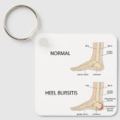 Porte-clés Bourse calcanique (Recto)