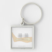 Porte-clés Fixator externe (Devant)