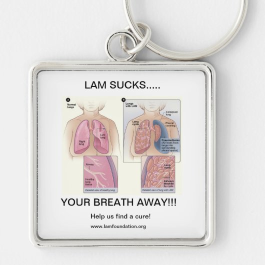 PORTE-CLÉS LA FUITE SUCE (Devant)