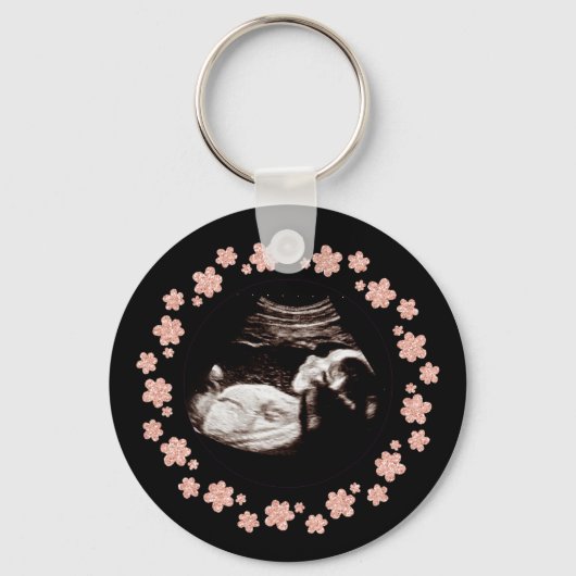 Porte-clés Parties scintillant de bébé grossesse Sonogramme U (Recto)