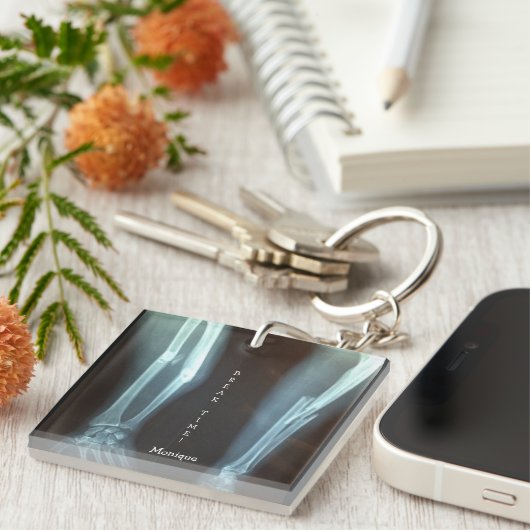 Porte-clés Rayon cassé et Ulna Xray "Temps de pause" (Devant Droit)