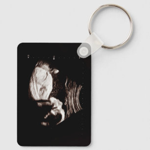 Porte-clés Ultrasons de bébé personnalisé
