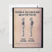 Positie van het skelet in goede en slechte toestan briefkaart (Voorkant / Achterkant)