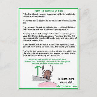Postale Comment retirer une carte d'instructions de frappe