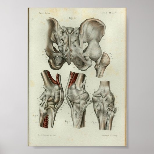 Poster 1844 Anatomie Vintage Imprimer le genou hanche (Devant)