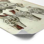 Poster 1844 Anatomie Vintage Imprimer le genou hanche (Coin)