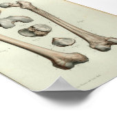 Poster 1844 Anatomie Vintage Imprimer l'os fémur (Coin)