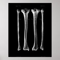 1844 Anatomie Vintage Imprimer Tibia Fibula
