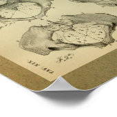Poster 1850 Anatomie Vintage Imprimer Pelvis (Coin)