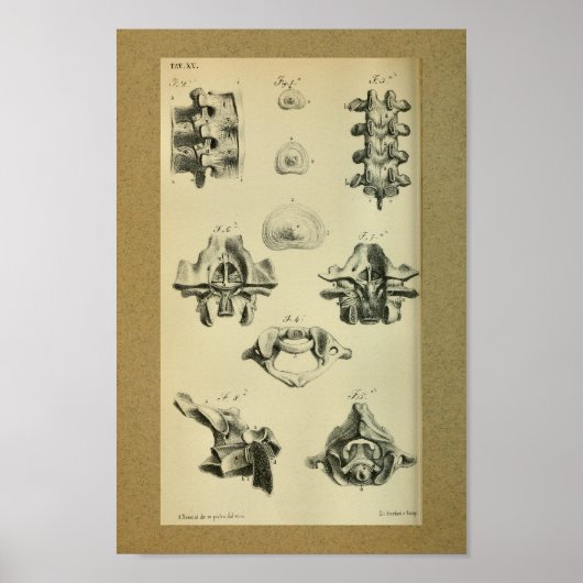 Poster 1850 Anatomie Vintage Imprimer Vertèbre épinière (Devant)