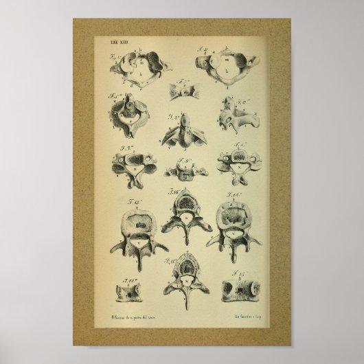 Poster 1850 Anatomie Vintage Imprimer Vertèbre épinière (Devant)