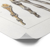 Poster 1867 Anatomie Vintage des os main (Coin)