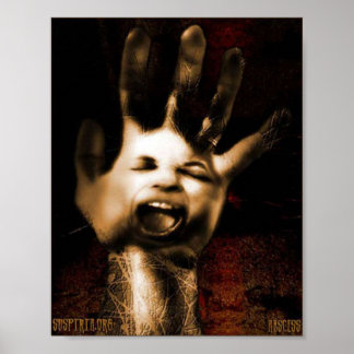Poster Abcès