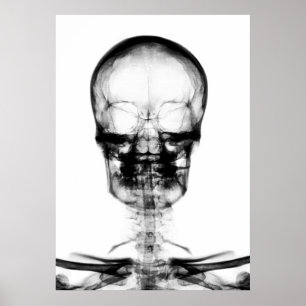 POSTER/AFDRUKKEN X-RAY VISION SKELETON SKULL - B&W POSTER