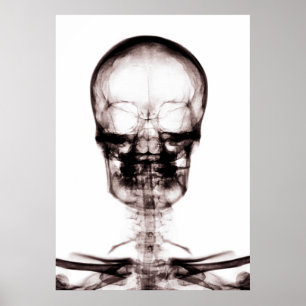 POSTER/AFDRUKKEN X-RAY VISION SKELETON SKULL ORIG/ POSTER