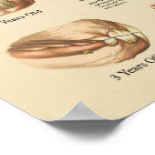 Poster Âge du cheval montré par la carte des dents (Coin)