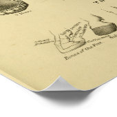 Poster Âge du cheval par dents Graphique Anatomie dentair (Coin)