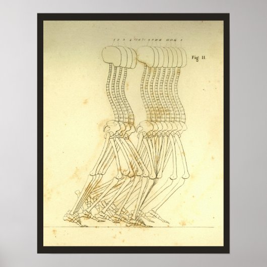 Poster Analyse de la démarche à pied Chiropratique de la  (Devant)