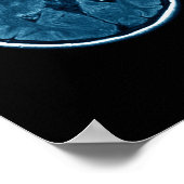 Poster Analyse Mri du cerveau (Coin)