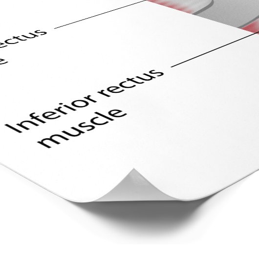 Poster anatomie conjunctiva des yeux (Coin)