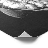 Poster Anatomie de l'aorte abdominale (Coin)