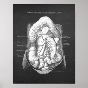 Poster Anatomie de l'aorte abdominale