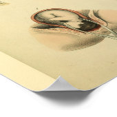 Poster Anatomie des forceps de naissance Anatomie Art Méd (Coin)