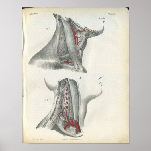 Poster Anatomie du cou des artères vertébrales Imprimer (Devant)