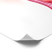 Poster Anatomie D'Une Fistule Trachéesophagienne (Coin)