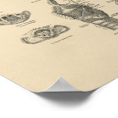 Poster Anatomie Larynx vintage 1880 Imprimer (Coin)