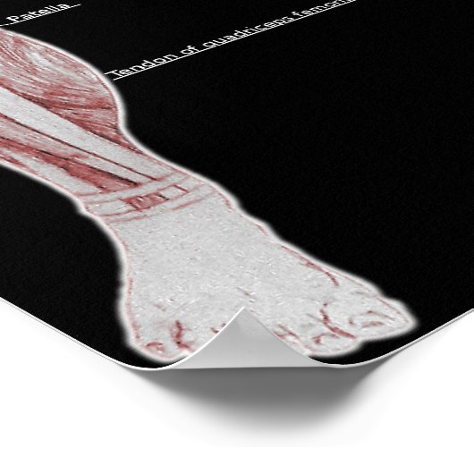 Poster Anatomie musculaire (Coin)