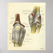 Poster Anatomie vintage Bones d'impression genou (Devant)