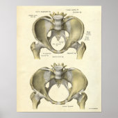 Poster Anatomie vintage Bones d'impression Pelvis (Devant)