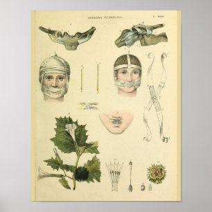Poster Anatomie Vintage de l'épaule