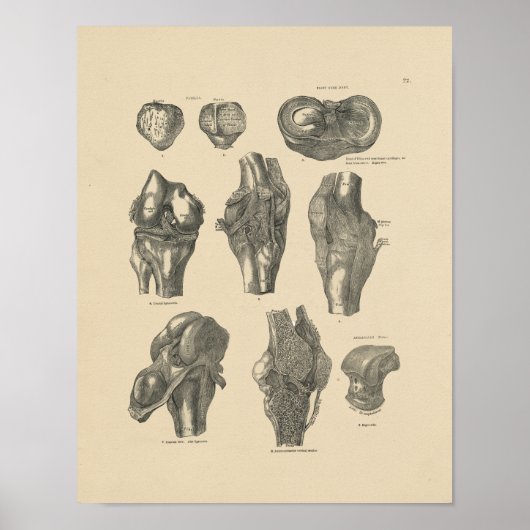 Poster Anatomie vintage du genou 1880 Imprimer (Devant)