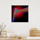 Poster Ankle Pain (Cuisine)