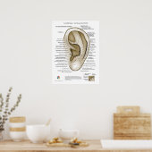 Poster Auriculothérapie Acupuncture de l'oreille (Cuisine)