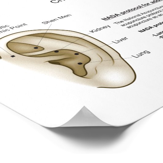 Poster Auriculotherapy Ear Acupuncture (Coin)