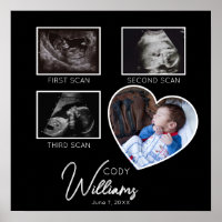 Baby Scan Photo sonogramme nouveau-né gardien de b
