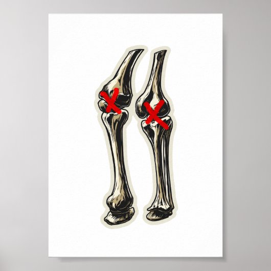 Poster Bad Knees – Funny Skeleton Knee Illustration (Devant)