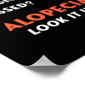 Poster Bald Balding Alopecia Areata Perte de cheveux Prob (Coin)